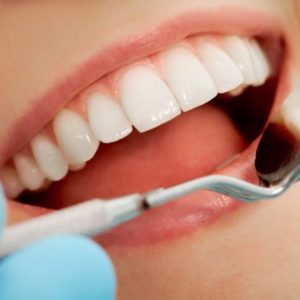 Mikor vállal a fogorvos garanciát a munkájára?